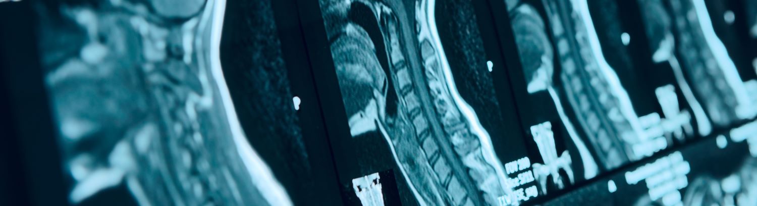 MVH Med Staff CME Library - Evolution of Head and Neck Reconstruction: Advances in Oromandibular Reconstruction Banner